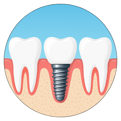 Root Canal Treatment, Best Dentist in Zirakpur 