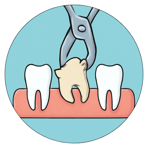 Root Canal Treatment, Best Dentist in Zirakpur 
